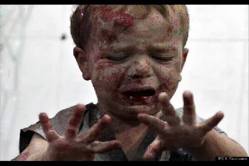 Niño Herido en Aleppo. (IImagen extraida de un Tweet de Syria --#Syria--)